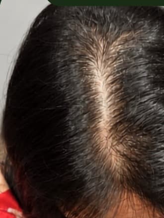 Scalp Defense Serum — sesudah pemakaian