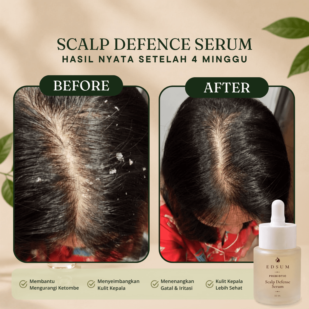 EDSUM Prebiotic Scalp Defense Serum 30 mL - foto 3
